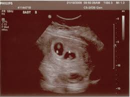 Blog En Baby Center En Espanol Las Netas De La Maternidad