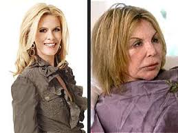 Alex McCord's Real Housewives of Miami Blog: More Elsa, Please!