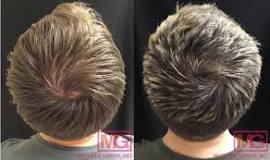 Image result