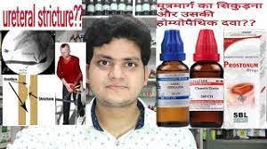 This medicine uses highly diluted natural substances to relieve symptoms. Urethral Stricture à¤® à¤¤ à¤°à¤® à¤° à¤ à¤¨ à¤¦ Homeopathic Medicine For Urethral Stricture Youtube