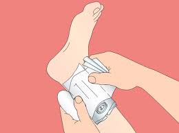 Mistenker legen at du kan ha fått en vanligvis rammes det øverste laget av hornhinnen (epitelet) og små sår kan oppstå. Liten Sarskole Norge