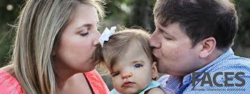 FACES: Better together with the National Craniofacial Association