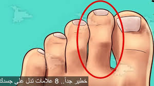 خطير جدا 8 علامات تدل على جسدك يحتاج العلاج فورا youtube