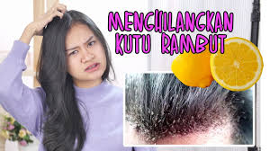 Cara menghilangkan kutu beras pertama yang bisa kamu lakukan adalah dengan menjemur beras yang dihinggapi kutu di bawah paparan sinar matahari langsung. Dijamin Kutu Rambut Hilang Ini Cara Menghilangkan Kutu Rambut Dengan Alami Youtube
