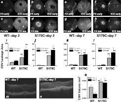 Sorsby Fundus Dystrophy Mutation in Tissue Inhibitor of Metalloproteinase 3  (TIMP3) promotes Choroidal Neovascularization via a Fibroblast Growth  Factor-dependent Mechanism | Scientific Reports