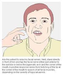 Learn vocabulary, terms and more with flashcards, games and other study tools. Fawwazrasydan On Twitter Positive Trousseau S Sign Positive Chvostek S Sign Suggests Hypocalcaemia Http T Co Jwjp8425wz