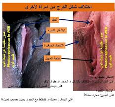 هل من الطبيعي أن تكون الاشفار منهدلة الصفحه الرسميه ل د Ahmad Ragab الثقافه الجنسيه Facebook