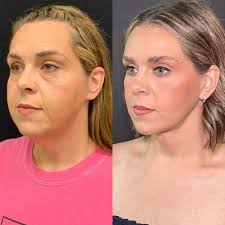 Robb Facial Plastic Surgery