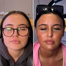 Real aesthetics by danielle duff