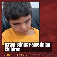 Israel Blinds Palestinian Children A Palestinian child with a wounded soul  and lost sight ... You remember, Muhammad Shaaban, 8 years old, a child  from the Gaza Strip who was wounded during