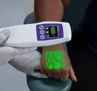 Vein Visualization System | AccuVein, Inc.