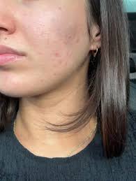 Let's welcome our new members! Afroza Aslam Kheya, Isatu Kolleh Koroma,  Alice Melody, Shirley Letsoara, Mercy Bright, Linda Robinson Bellew,  Blessing Mum Victory, Debby Boakye, Kainat Siddiqui, Ankita Sarkar, Hlengy  Bhebhe Kamthandeka,