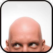 Maybe you would like to learn more about one of these? Rambut Rontok Transplantasi Rambut Ekstraksi Unit Folikel Skinhead Rambut Wajah Orang Orang Png Pngegg