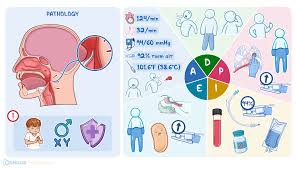 Image result for Epiglottitis