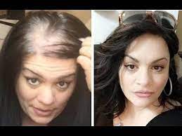 How To Hide Thin Balding Head With Hair Topper Youtube Thin Hair Styles For Women Hair Loss Wigs Thin Hair Haircuts