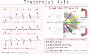 Image result for R Wave