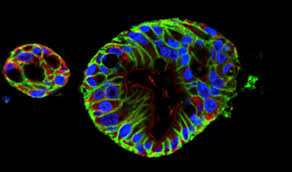 Scientists create intestine-derived organoids as a model to study  necrotizing enterocolitis | MDLinx