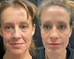 Amy Falls, BSN, RN, CANS