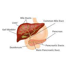 Biliary atresia, also known as extrahepatic ductopenia and progressive obliterative cholangiopathy, is a childhood disease of the liver in which one or more bile ducts are abnormally narrow, blocked, or absent. Biliary Atresia Niddk