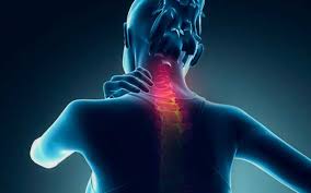 9 Dicas Para O Tratamento Da Cervicalgia Que Ninguem Te Contou