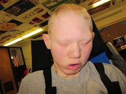 Hunter William Kuipers Obituary February 20, 2019