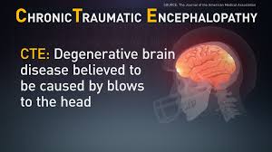 What does cte stand for? What Is Cte And How Does Football Increase The Risk Wthr Com