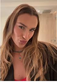 Sabalenka Lips Before After