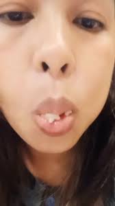 Bakit Dapat Iwasan ang Pagkaing hindi Masustansiya?