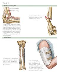 Image result for Fracture Complication