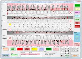 Periodontal Charting Software Opchart