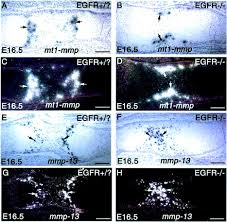 The 2014 blue falcon award goes to sgt. Epidermal Growth Factor Receptor Deficient Mice Have Delayed Primary Endochondral Ossification Because Of Defective Osteoclast Recruitment Journal Of Biological Chemistry
