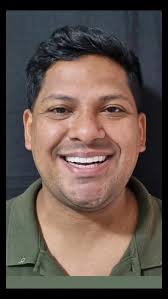 Mais um sonho realizado com as facetas premium. @dany_costa1988