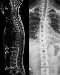 The thoracic vertebrae function to support the back. Epos Trade