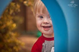 Why Do People With Down Syndrome Look Alike Siowfa15 Science In Our World Certainty And Controversy
