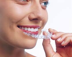 Die innen liegende zahnspange (lingualtechnik. Invisalign Hannover Dres W J Entrup Dr T Altvater