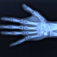 C'est d'ailleurs pour cette raison que. Os De La Main Anatomie Physiologie Douleurs