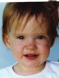 Children Referred for Speech Delays SERVICE GUIDELINE 3