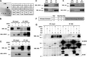 Yh tan & associates plt. Hematopoietic Progenitor Kinase 1 Down Regulates The Oncogenic Receptor Tyrosine Kinase Axl In Pancreatic Cancer Journal Of Biological Chemistry