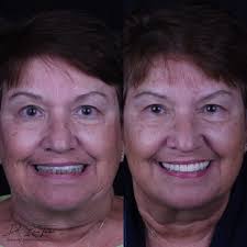 Tindal Prosthodontics