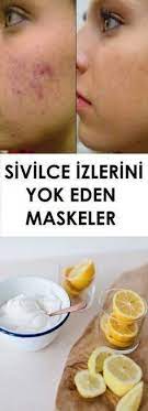 Sivilce Izlerini Yok Eden Cok Etkili Maske Tarifleri Vipbakim Sivilce Izi Maskeler Cilt Bakimi