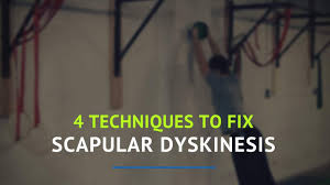I know this comment is late but how long would it take a fix the problems? 4 Techniques To Fix Scapular Dyskinesis Precision Movement