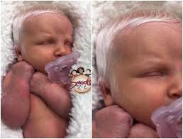 Baby's elder sister heard the squeal of the baby, and ran. Photo Baby Born With White Hair Mojidelano Com