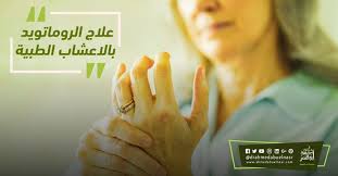 طرق علاج الروماتويد بالاعشاب الطبيعية holding hands hands