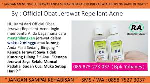 Ubat Jerawat Batu Ubat Jerawat Pasir Ubat Jerawat Paling Berkesan Obat Jerawat Alami Obat Jerawat Ampuh Obat Untuk Jerawat Nana Jerawat Obat Jerawat Sabun