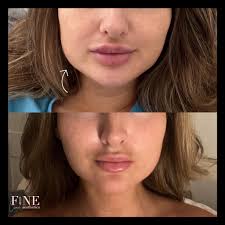 Looking for a more subtle lash look? I've got you covered. My client wanted  lashes that complemented her face without overpowering it, so we opted for  some delicate cat eye hybrids. Limited