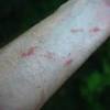 All parts of common pokeweed are toxic to humans, pets and livestock. Https Encrypted Tbn0 Gstatic Com Images Q Tbn And9gcsmyj9 9zyvoj6nliph3syuwr Lvvv Ctfu Xa2gdwiwz89a4g1 Usqp Cau