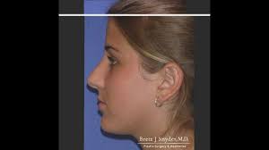 💥WE ARE OPEN!!💥 Introducing the newest addition to Solano Plastic  Surgery: 💉👄Bella Solano MediSpa! 💉👄 It's located