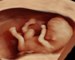 Ssw liegt in der mitte des dritten schwangerschaftsmonats und leitet das ende der frühschwangerschaft ein. Feindiagnostik Frauenarztpraxis Jobst