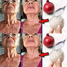 Natural Onion-Based Face Whitening Recipe Using Onion