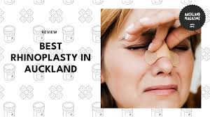 The 4 Auckland Rhinoplasty Experts for Noses That Wow [2025]